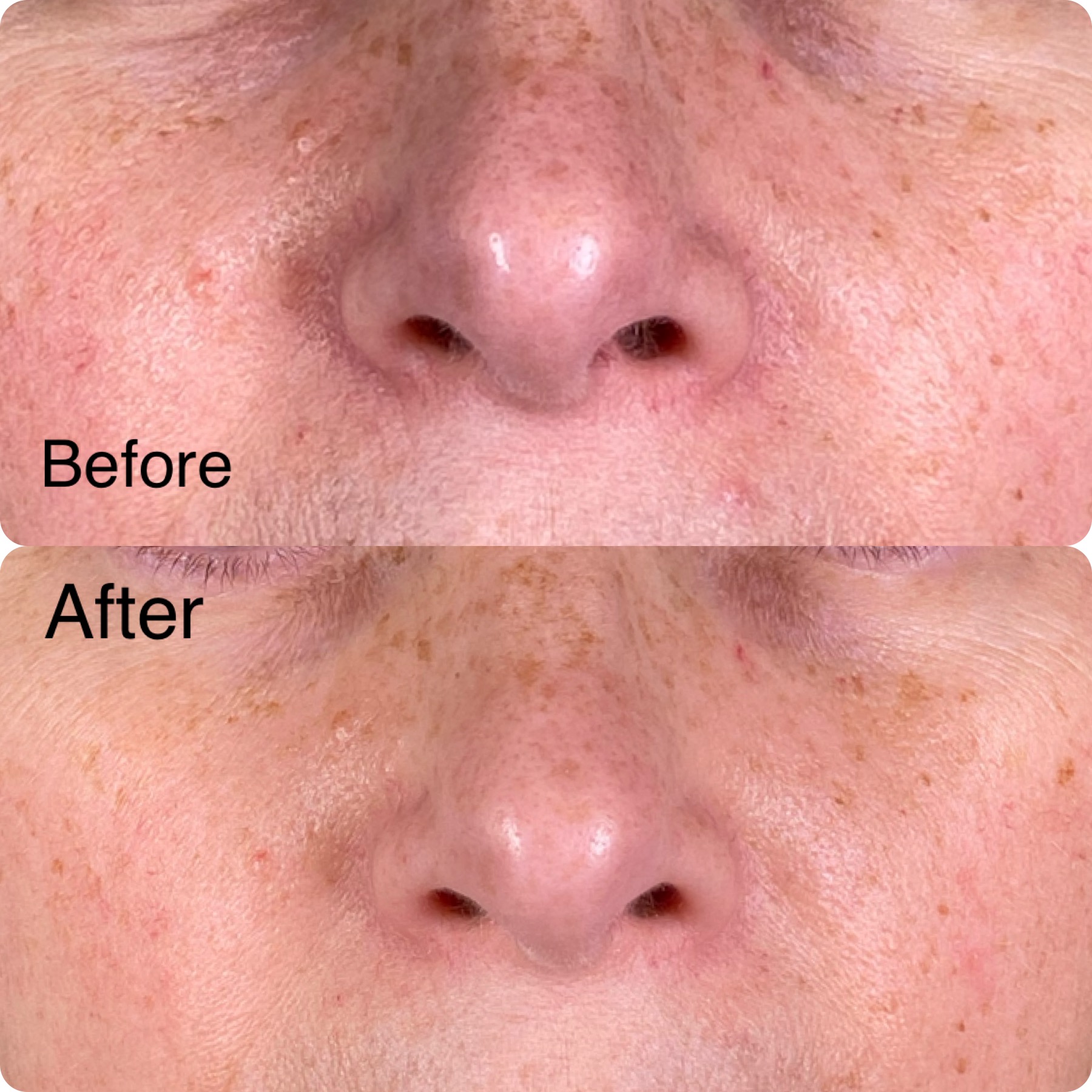 before after oligio_origins2