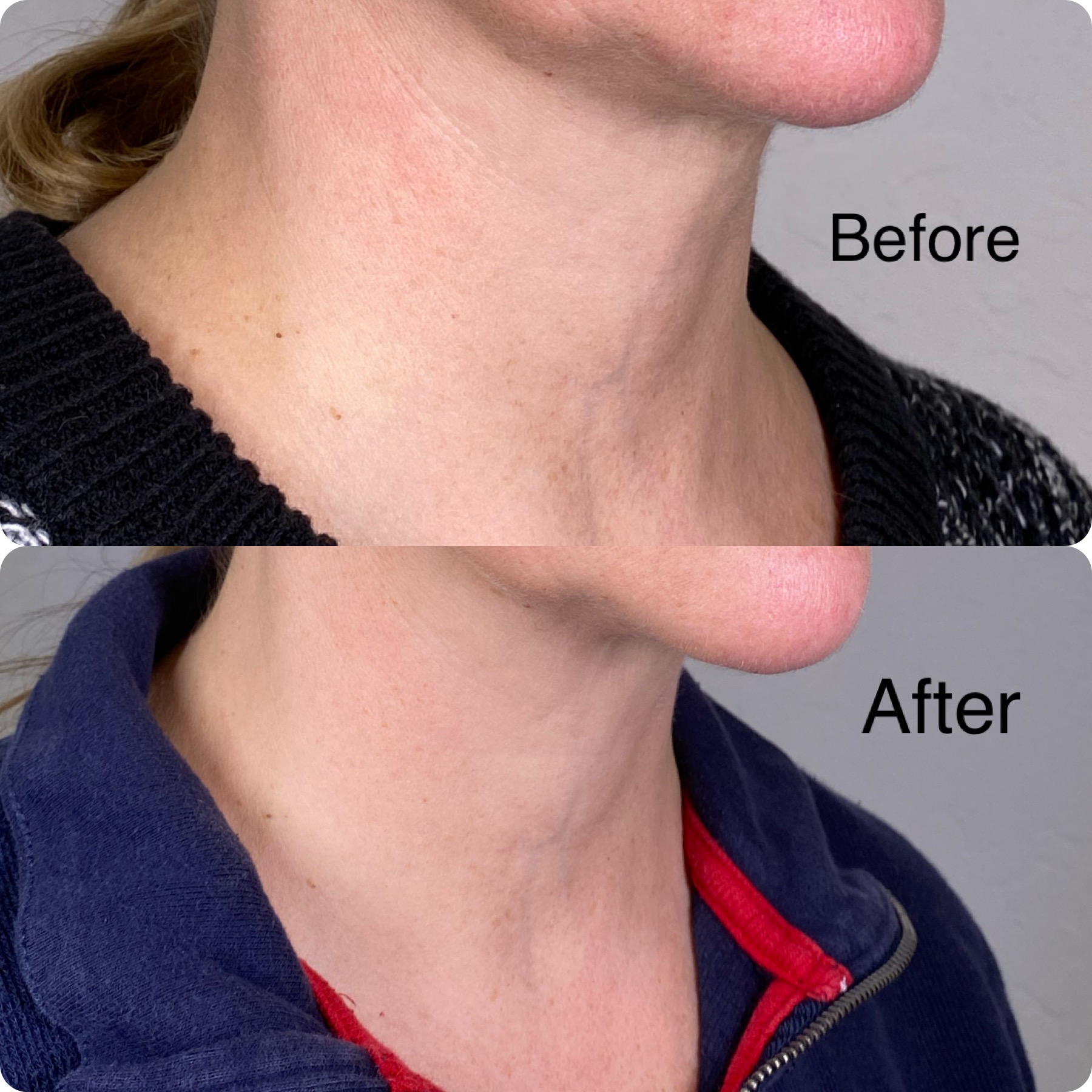 before after oligio_origins3