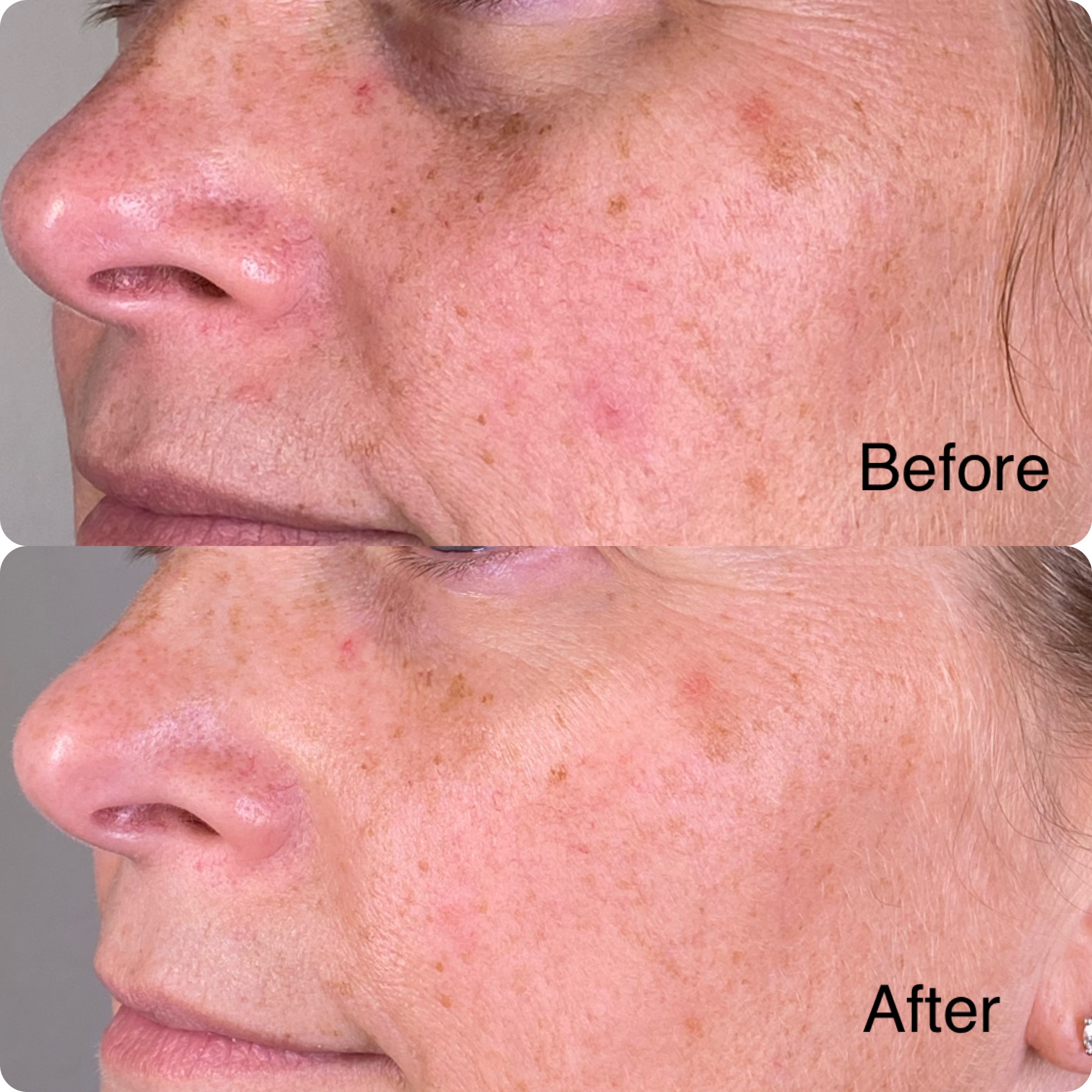 before after oligio_origins4