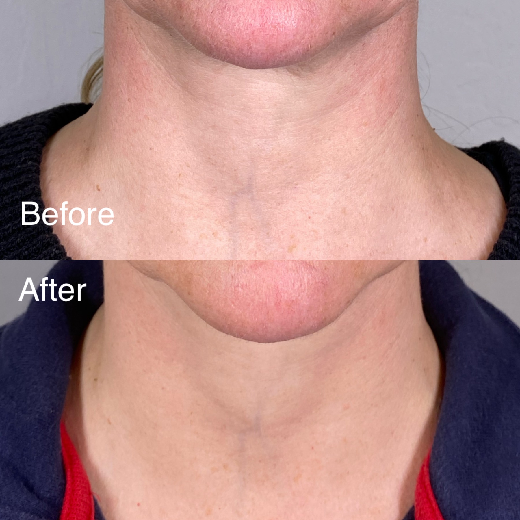 before after oligio_origins5